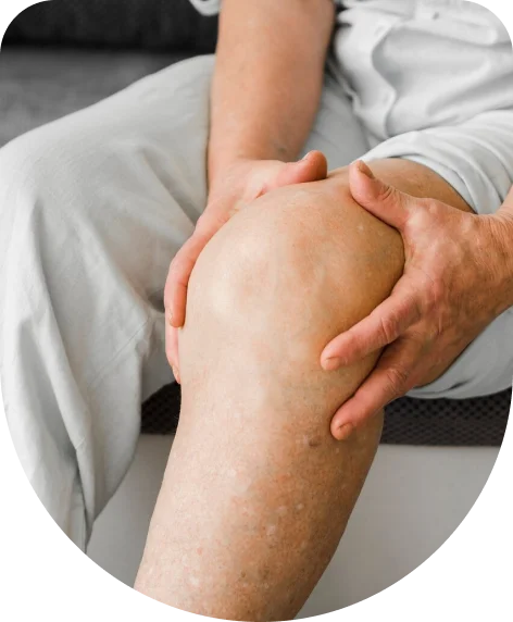 Venous Insufficiency